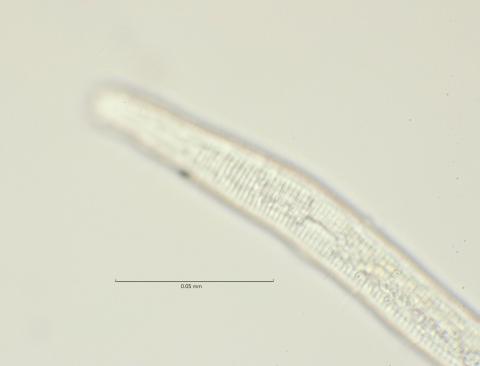 lateral field at oesophagus end, 100x