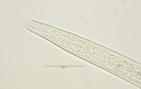 head region with dorsal tooth, 100x