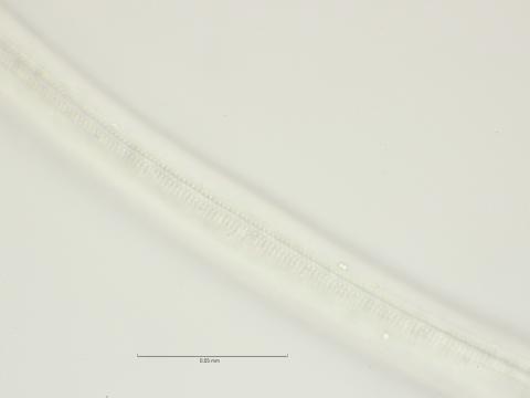 lateral field at mid body, 100x