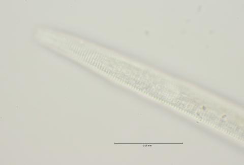 lateral field at oesophagus end, 100x