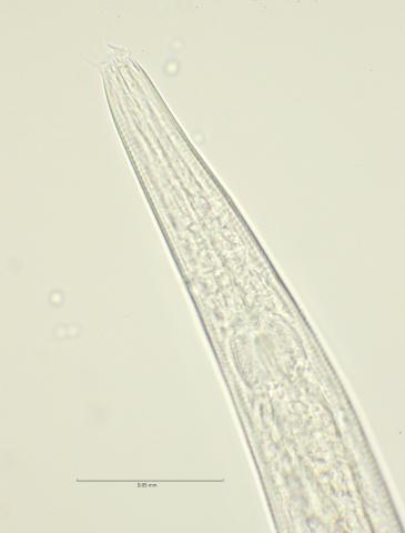 Dichromadora geophila, female head region with dorsal tooth, 100x