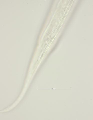 Dichromadora geophila, female lateral field at anus region, 100x