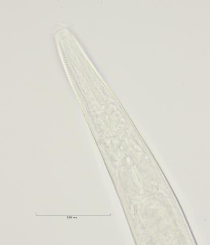 Dichromadora geophila, female lateral field at head region, 100x