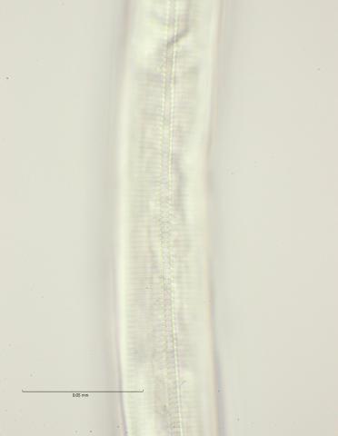 Dichromadora geophila, female lateral field at mid body, 100x