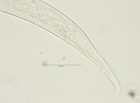 Dichromadora geophila, male cloaca region, 100x, stack