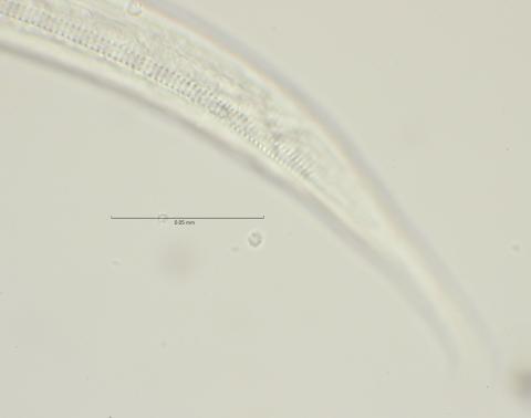 Dichromadora geophila, male, lateral field at cloaca region, 100x