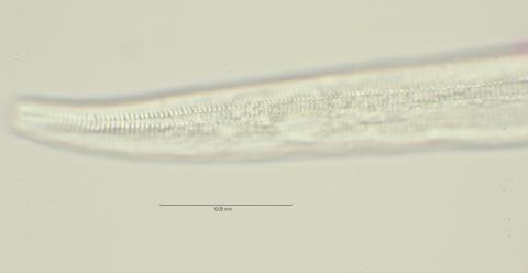 Dichromadora geophila, male, lateral field at oesophagus end, 100x