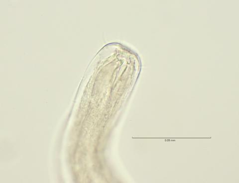 head region with dorsal tooth, 100x