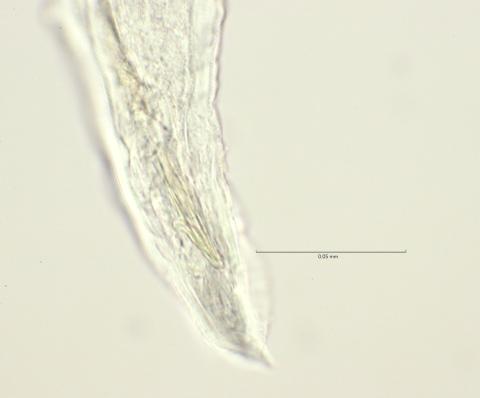 cloaca region w gubernaculum, 100x