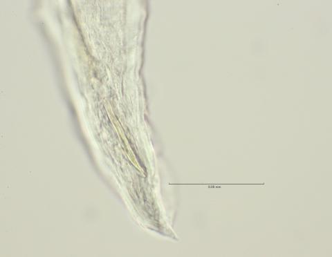 cloaca region with right spiculum, 100x