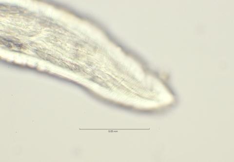 head region with cuticula structure, 100x