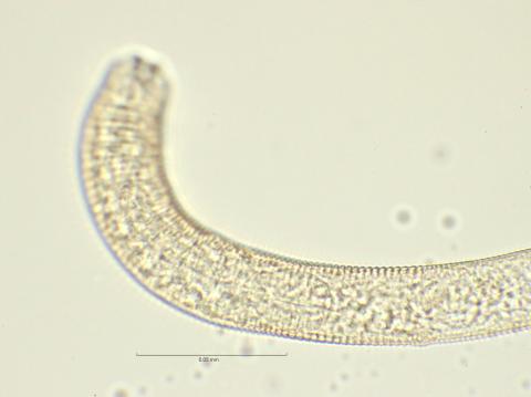 oesophagus end, 100x