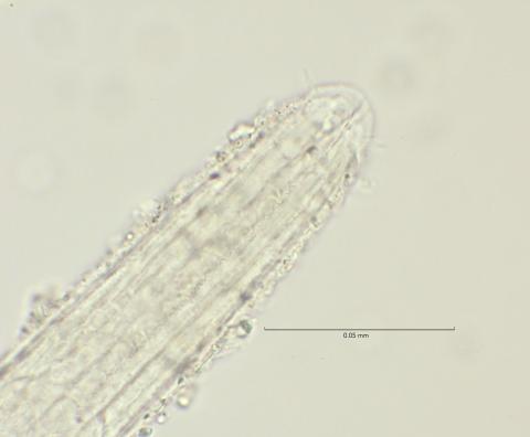 head region with cephalic setae, 100x