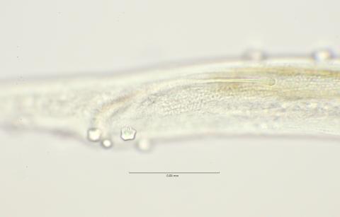 cloaca region with anterior end of spiculum, 100x