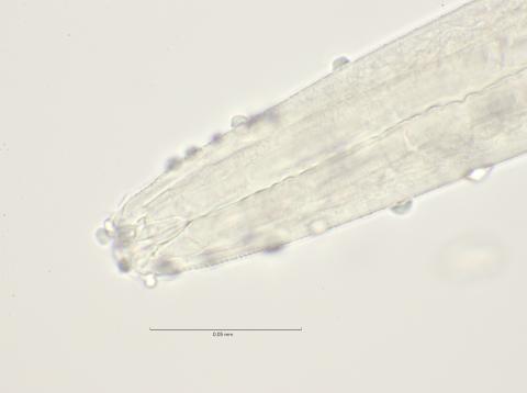 head region with dorsal tooth, 100x