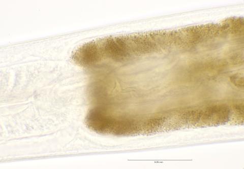 gut with spicula of prey, 100x