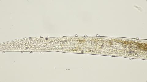 posterior part Demannian system, 40x