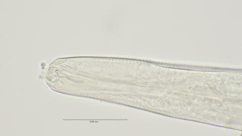 head region with dorsal tooth, 100x