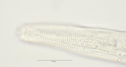 lateral field at head region, 100x