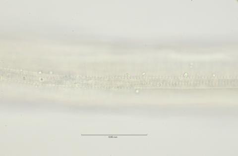 lateral field at mid body, 100x