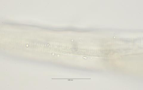 lateral field at oesophagus end, 100x