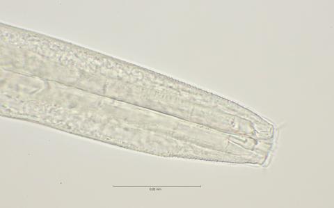 head region w dorsal tooth, 100x