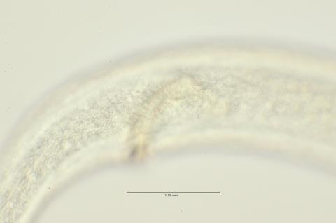 lateral field at cloaca region, 100x