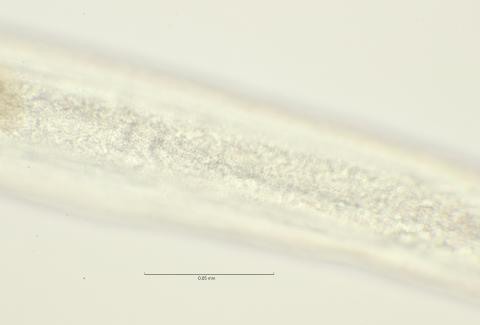 lateral field oesophagus region, 100x