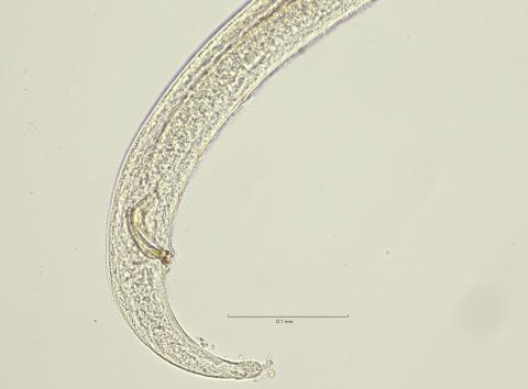 tail region, 40x