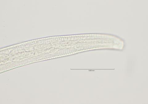 lateral field at head region, 100x