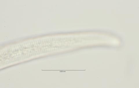 lateral field at oesophagus end, 100x