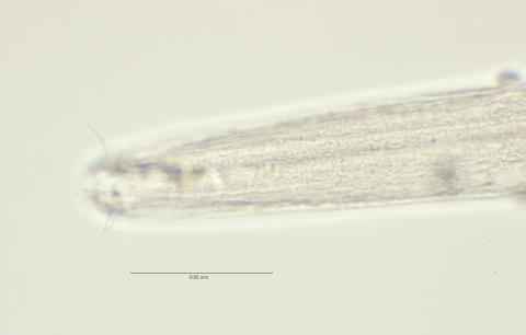 head region with cephalic setae, 100x