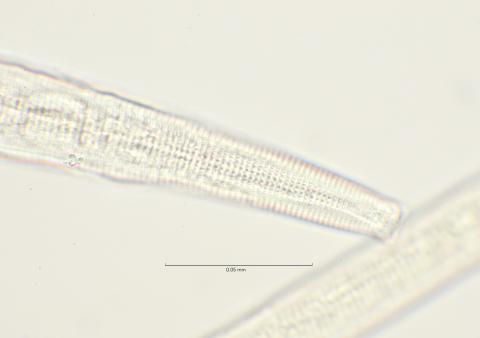 head region with cephalic setae, 100x