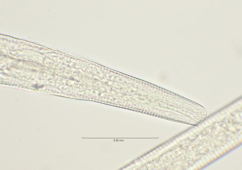 head region with dorsal tooth, 100x