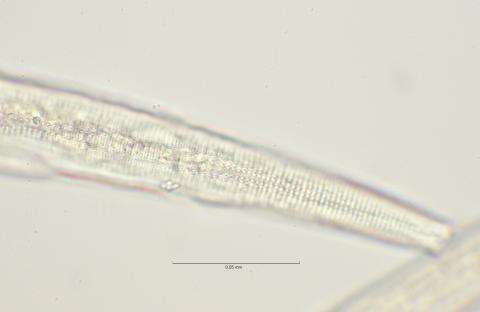 lateral field oesophagus region, 100x