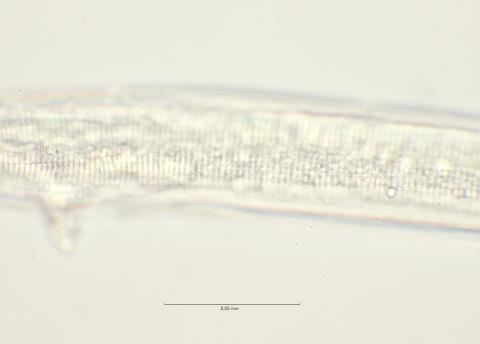 lateral field at mid body, 100x