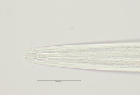 head region with cephalic setae, 100x