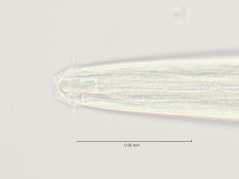 head region with denticles, 100x