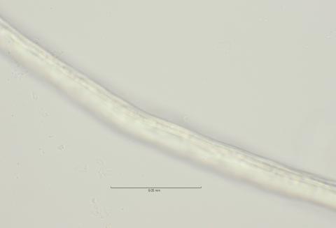 lateral field at mid body, 100x