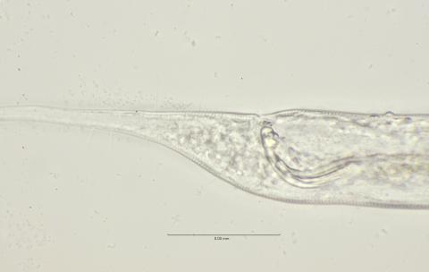 cloaca region, 100x stack