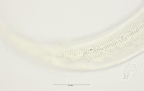 lateral field at cloaca region, 100x