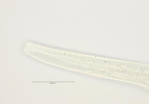 lateral field at head region, 100x