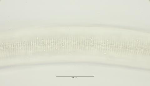 lateral field at mid body, 100x