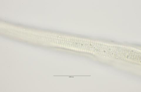 lateral field at oesophagus end, 100x