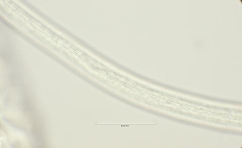 lateral field at mid body, 100x