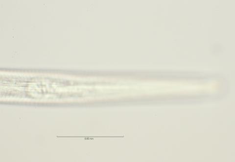 lateral field at oesophagus end, 100x