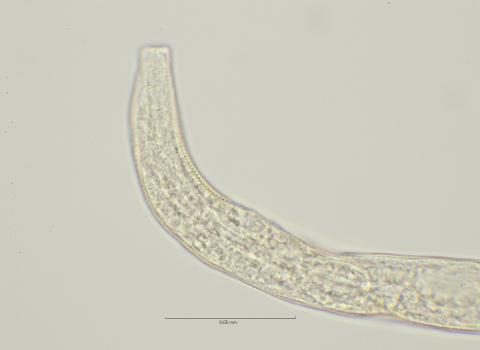 head region with right amphid, 100x