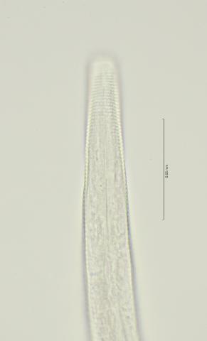 lateral field at head region, 100x