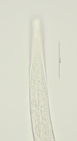 lateral field oesophagus region, 100x