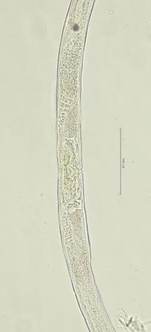 vulva region, 40x